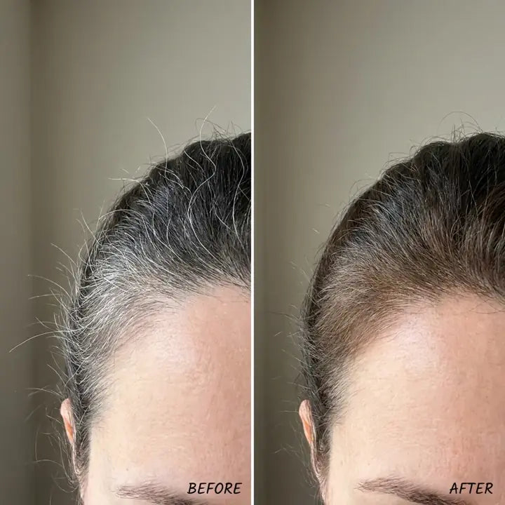 Yvonne, before and after