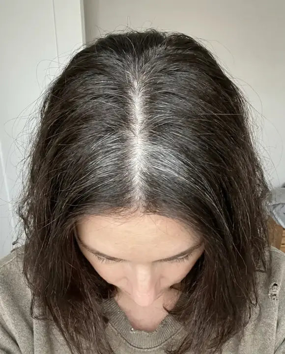 Gray roots showing